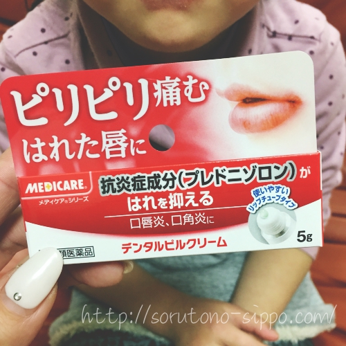 舌なめ皮膚炎 口まわりの赤いただれを治す方法 病院と市販薬 そるとのしっぽ